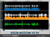 Synchro Arts VocALign Project 3 - Upgrade from non-ilok VocALign Project